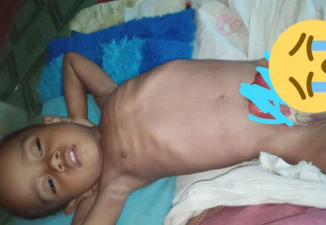 https://seputarmadura.com/wp-content/uploads/2020/06/Bayi-Berusia-21-Bulan-Terserang-Kanker-Ganas-Butuh-Uluran-Tangan-Dermawan-.jpg